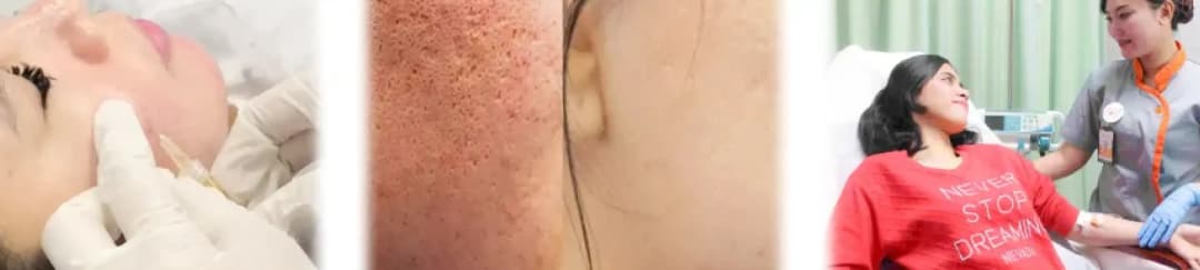 Cosmetic Dermatology