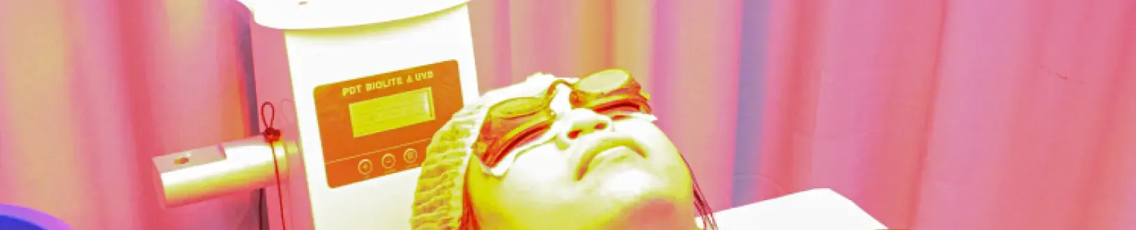 Photo Dynamic Therapy(PDT)