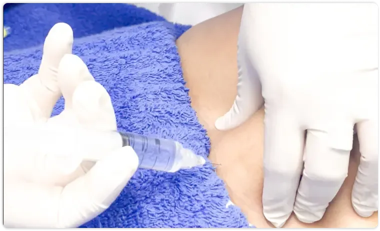 Messo Lipolysis Injection